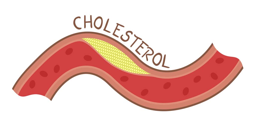 Cholesterol